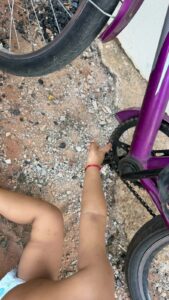 Criança de 2 anos prende dedo na corrente de bicicleta e é socorrida pelos Bombeiros em Lucas do Rio Verde